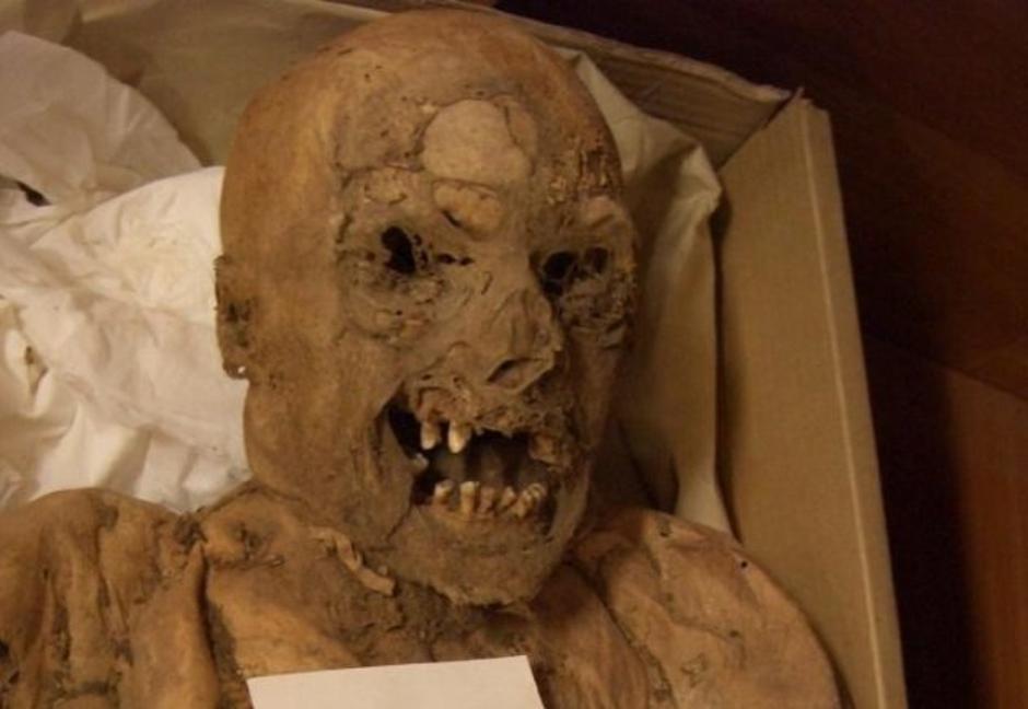 Mađarska mumija na kojoj su proučavali rak | Author: Atlas Obscura