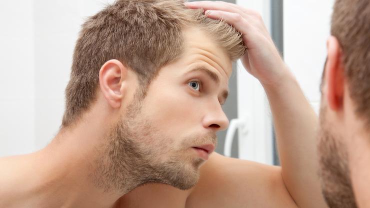 Muškarac u ogledalu promatra gubitak kose