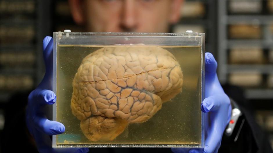 Ljudski mozak u staklenci | Author: Wikimedia Commons