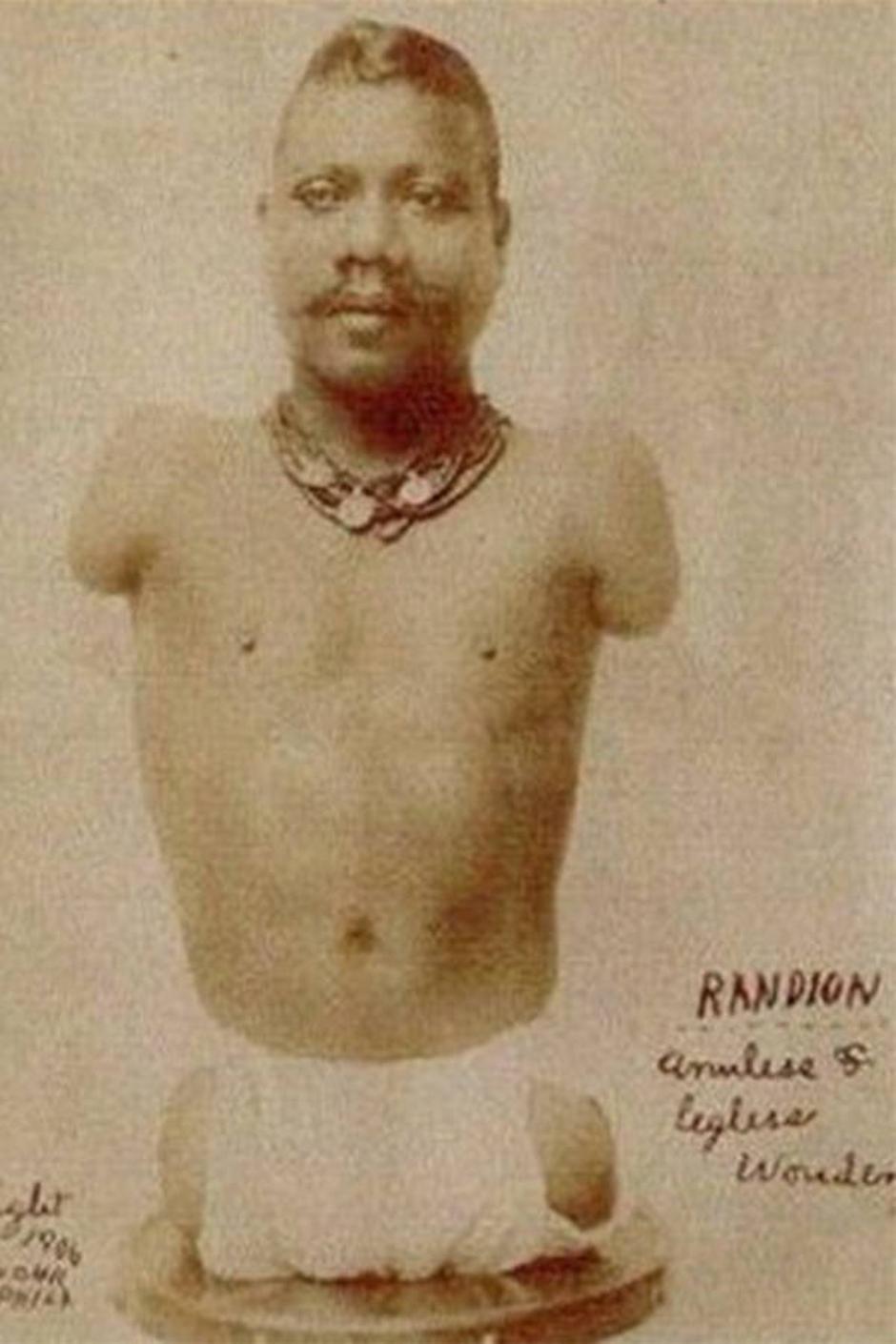 Prince Randian | Author: Wikipedia