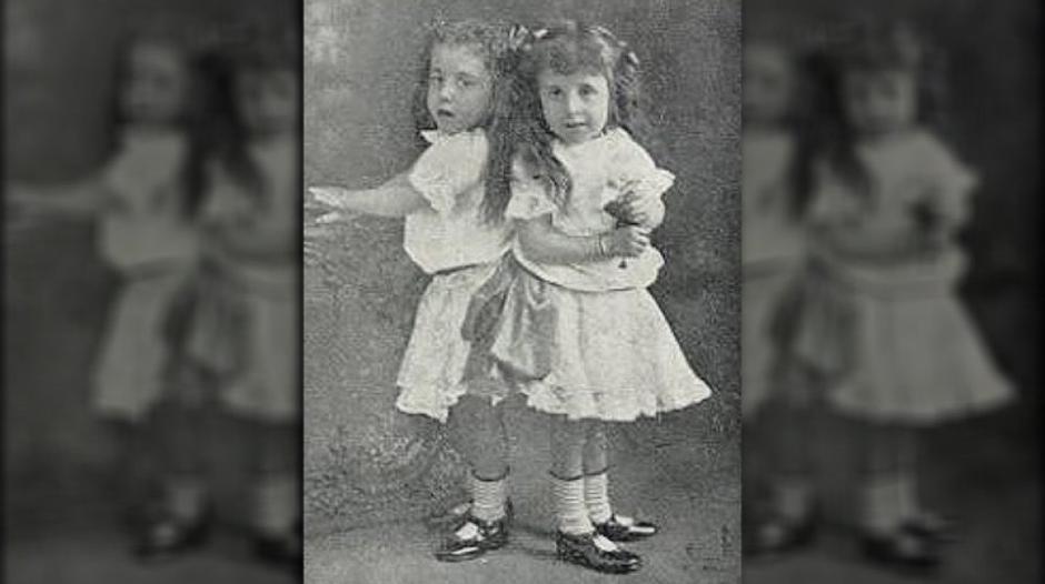 Daisy i Violet Hilton | Author: Wikimedia Commons