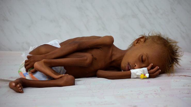 Jemenu zaprijetila glad