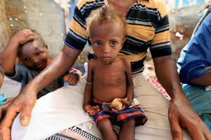 Glad u Jemenu