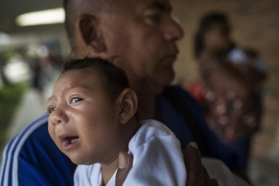 Djevojčica oboljela od zika virusa | Author: Rafael FABRES/DPA/PIXSELL