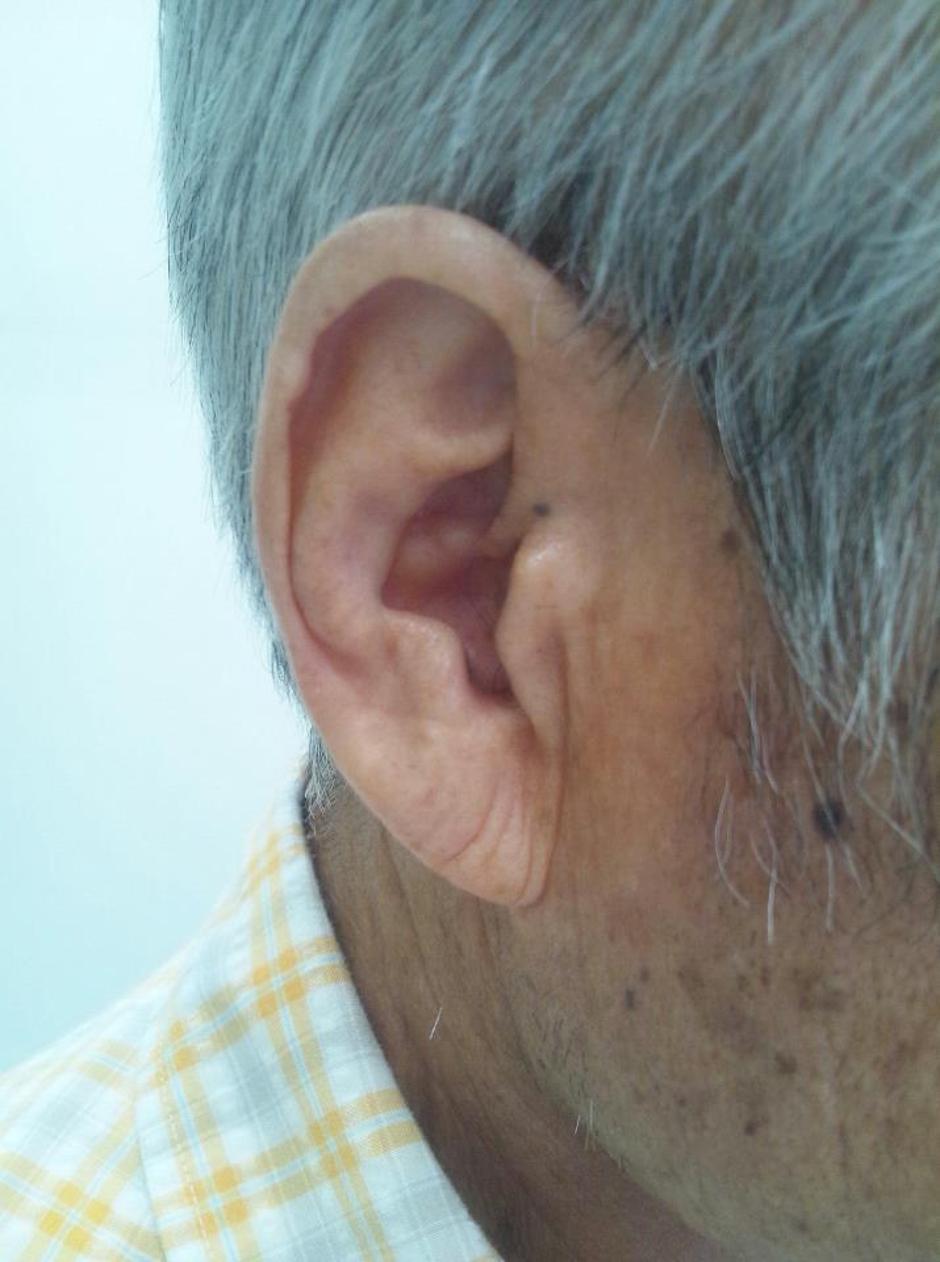 Frankov znak na ušima | Author: Wikimedia Commons